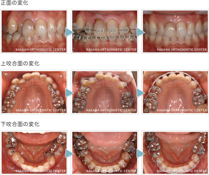 歯列矯正治療の変化